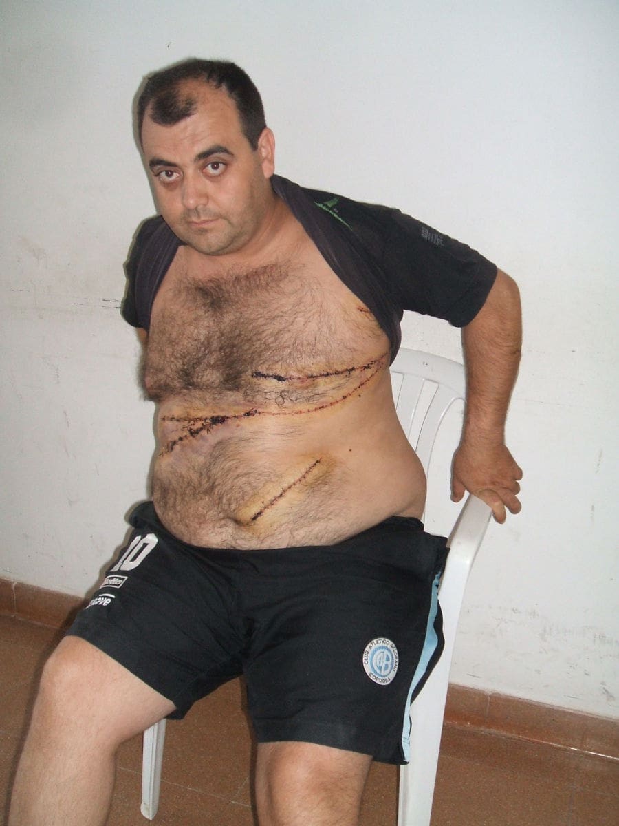 remisero apunalado 1 - Diario Resumen de la región