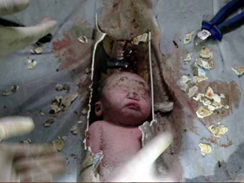China: Rescataron un bebé arrojado a un inodoro (AFP)