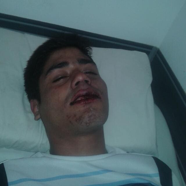 JOVEN GOLPEADO 1 - Diario Resumen de la región