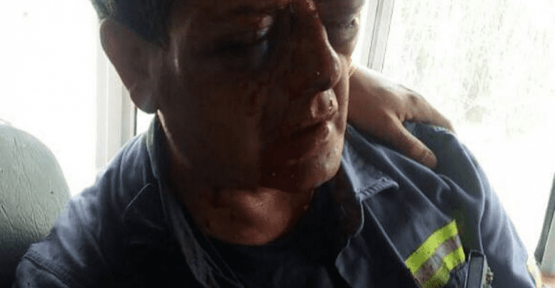 Maquinista golpeado - Diario Resumen de la región