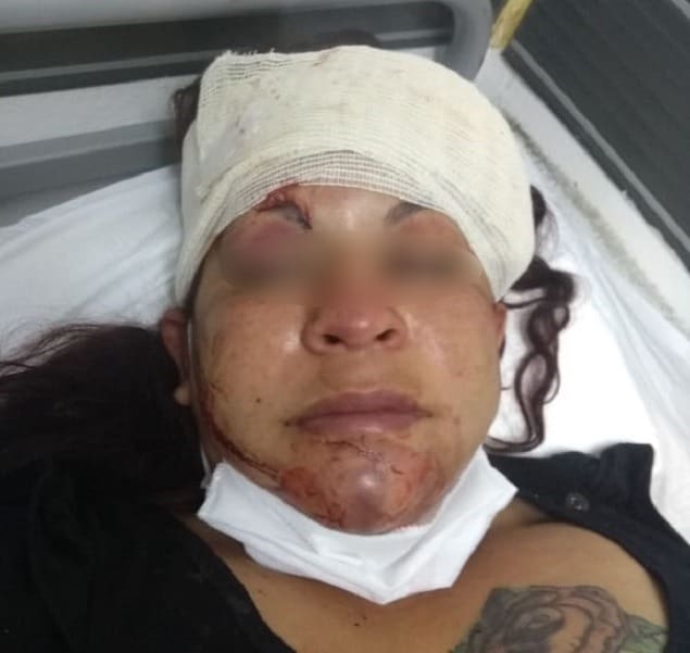 mujer golpeada anisacate - Diario Resumen de la región