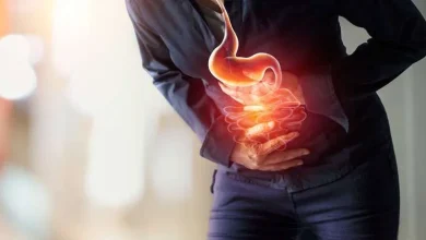 es upset stomach blog lg - Diario Resumen de la región