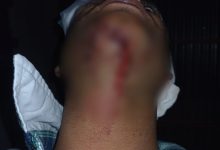 Imagen 271360 - Diario Resumen de la región