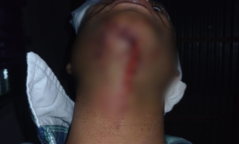 Imagen 271360 - Diario Resumen de la región